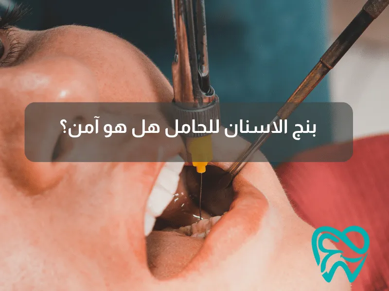 بنج الاسنان للحامل_ هل هو آمن؟