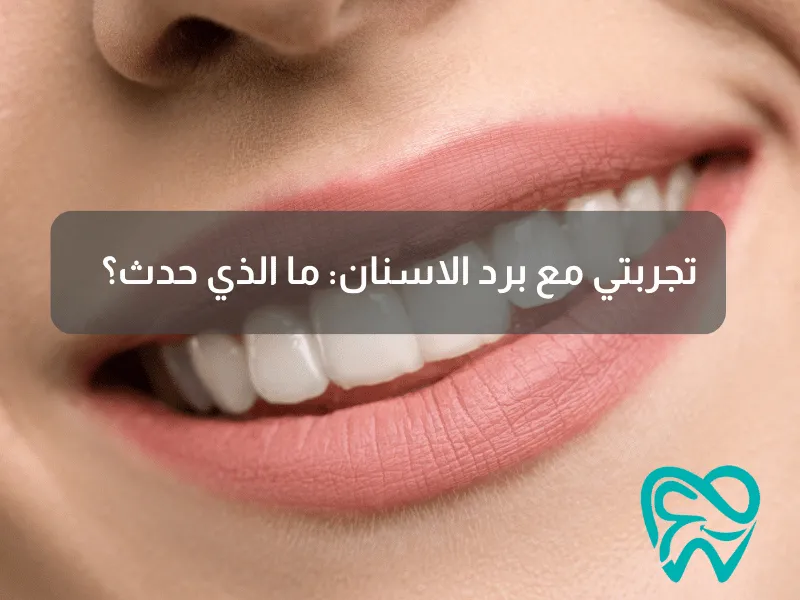 تجربتي مع برد الاسنان_ ما الذي حدث؟
