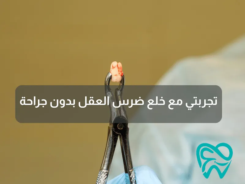 تجربتي مع خلع ضرس العقل بدون جراحة
