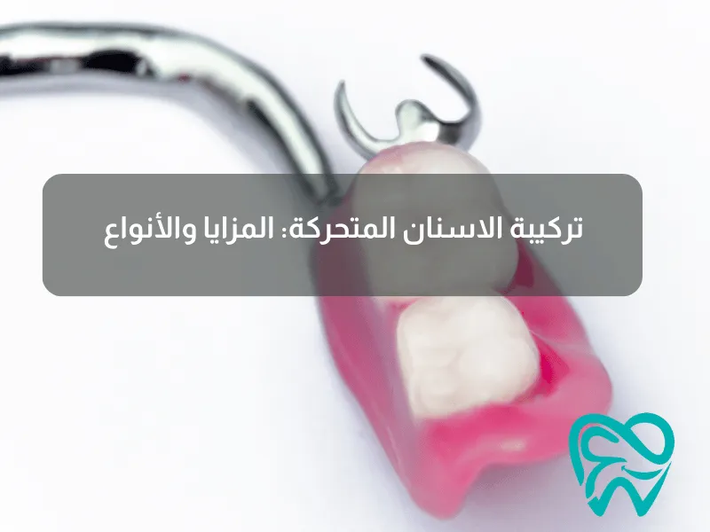 تركيبة الاسنان المتحركة_ المزايا والأنواع