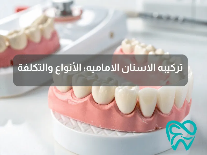 تركيبه الاسنان الاماميه_ الأنواع والتكلفة
