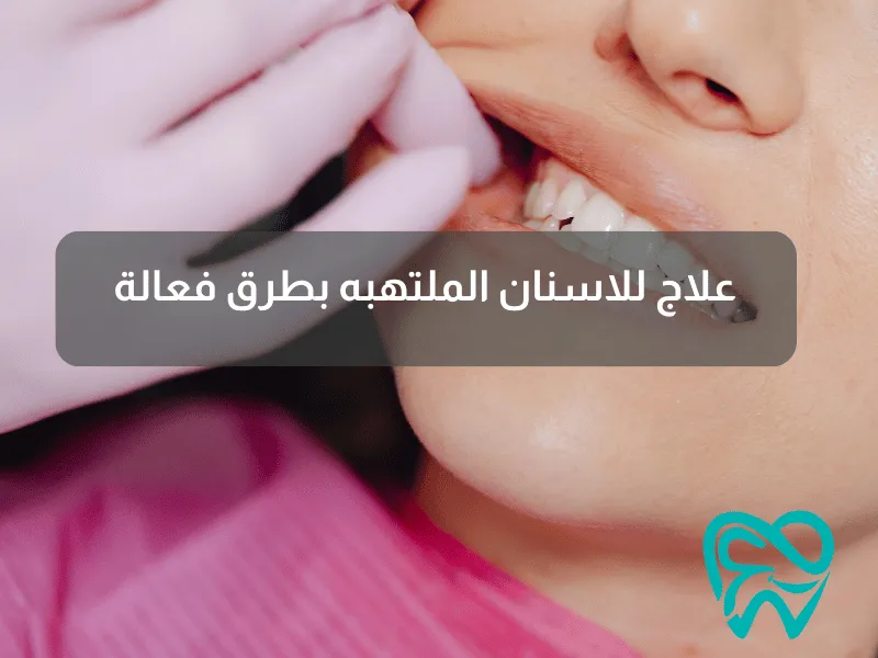 علاج للاسنان الملتهبه بطرق فعالة