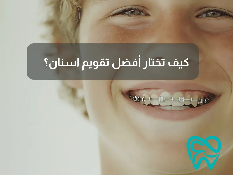 كيف تختار أفضل تقويم اسنان؟