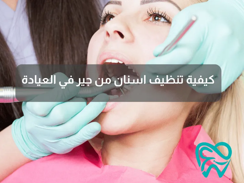 كيفية تنظيف اسنان من جير في العيادة