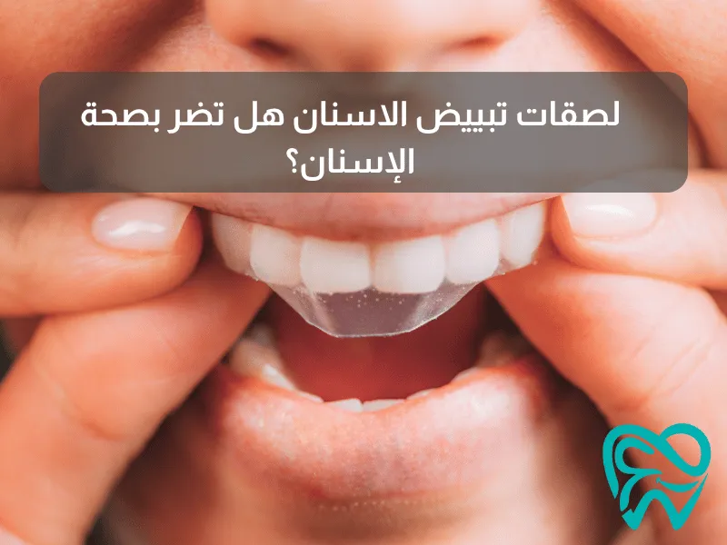 لصقات تبييض الاسنان هل تضر بصحة الإسنان؟