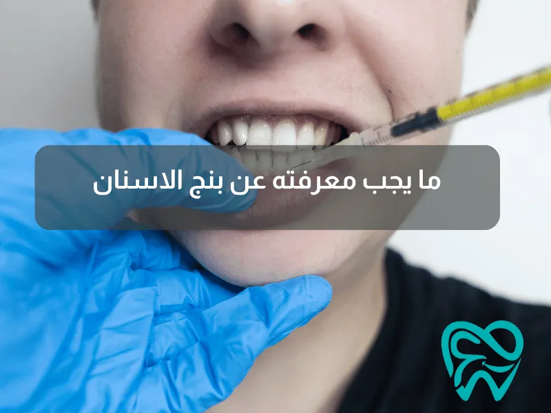 ما يجب معرفته عن بنج الاسنان